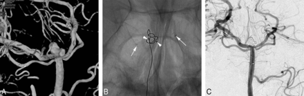 Fig 2.