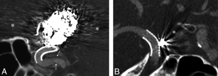 Fig 2.