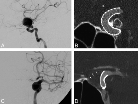Fig 3.