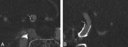 Fig 4.