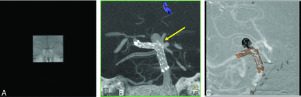 Fig 6.