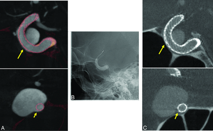 Fig 7.