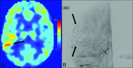 Fig 2.