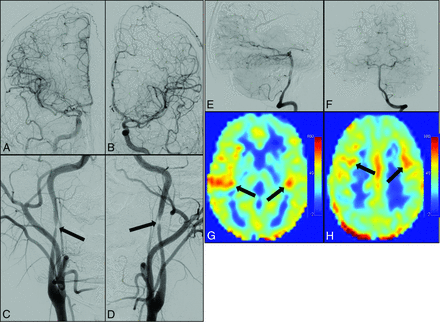 Fig 5.