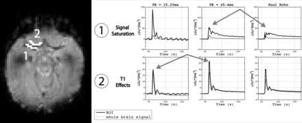 Fig 1.