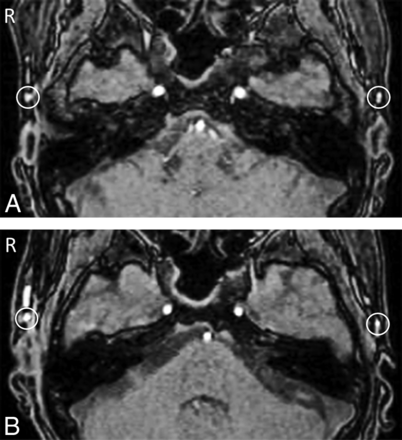 Fig 3.