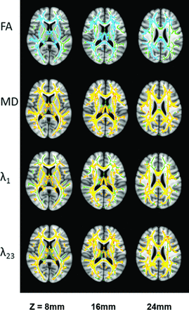 Fig 3.