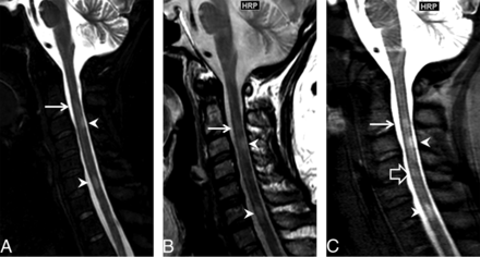 Fig 3.