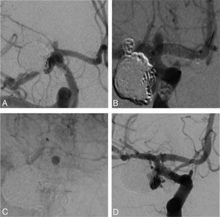 Fig 2.