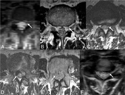 Fig 4.