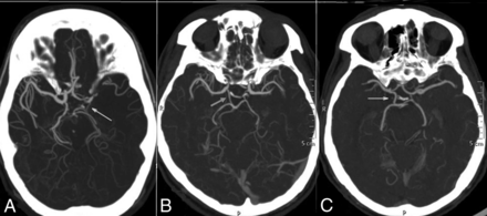 Fig 2.