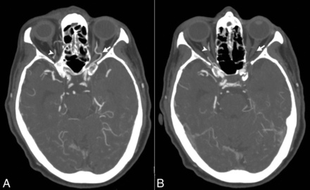 Fig 4.