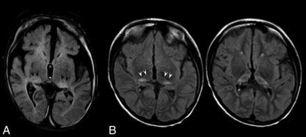Fig 4.
