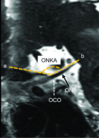 Fig 1.