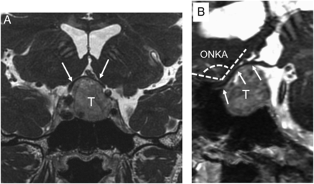 Fig 2.