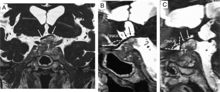 Fig 3.