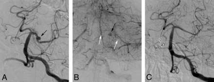 Fig 3.