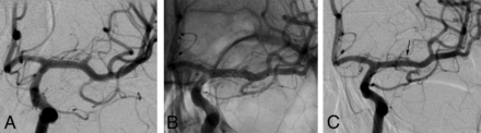 Fig 4.