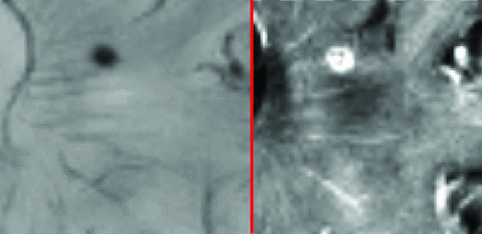 Fig 4.