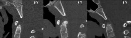 Fig 5.