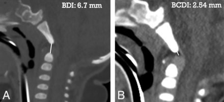 Fig 6.