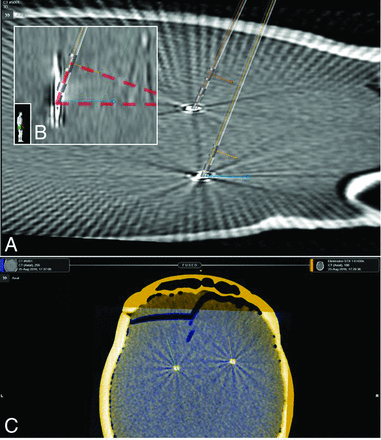 Fig 1.