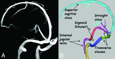 Fig 1.