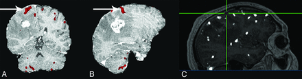 Fig 4.