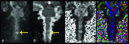 Fig 3.