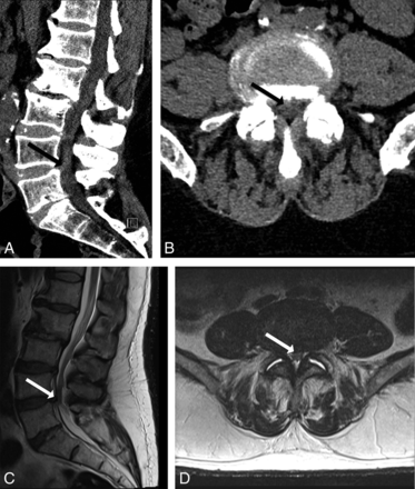Fig 2.