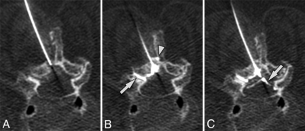 Fig 1.