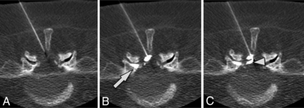 Fig 2.