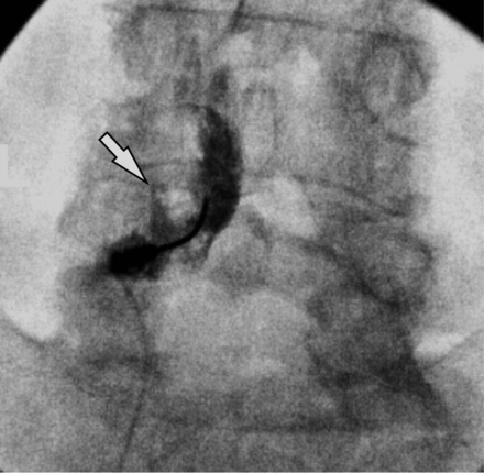 Fig 3.