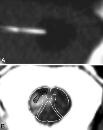 Fig 1.