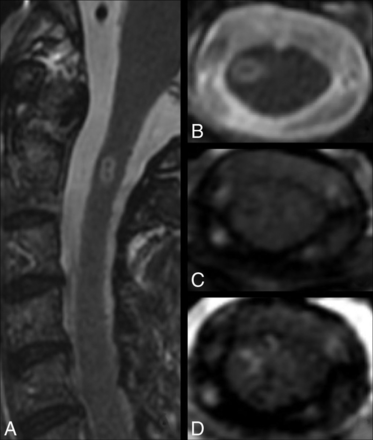 Fig 4.