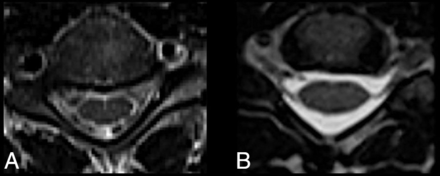 Fig 3.