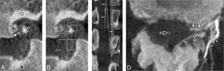 Fig 4.