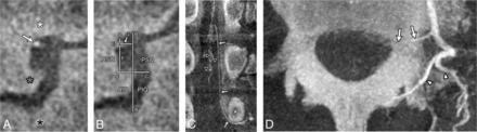 Fig 5.