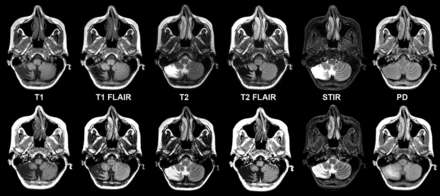 Fig 3.
