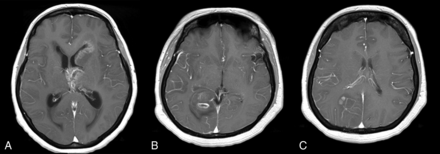 Fig 4.