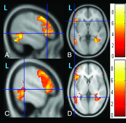 Fig 2.