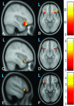 Fig 3.