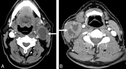 Fig 1.