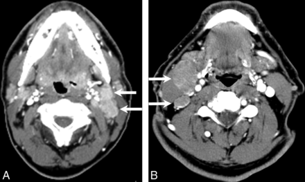 Fig 2.