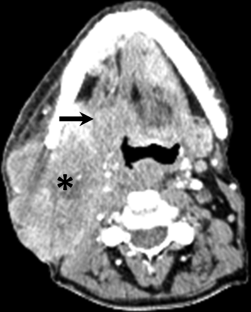 Fig 3.