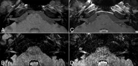 Fig 2.