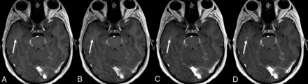 Fig 3.