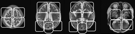 Fig 1.