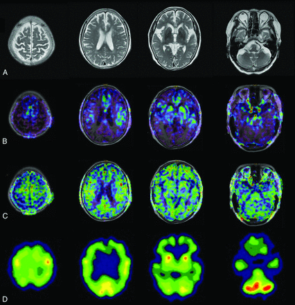 Fig 3.