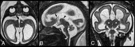 Fig 1.